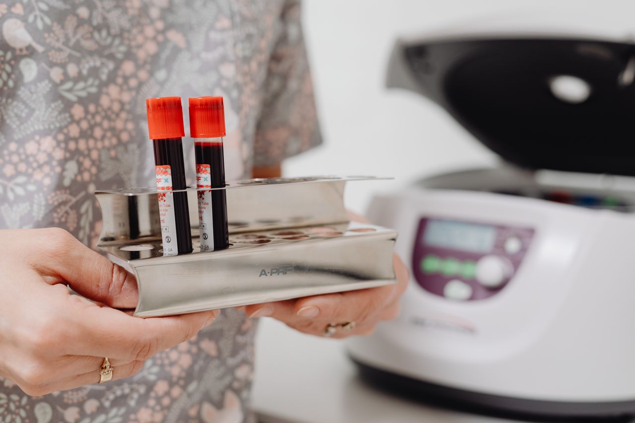 Menu Close-up of blood vials in a laboratory setting, ready for testing.